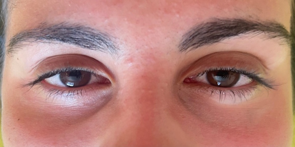 lifting de cils