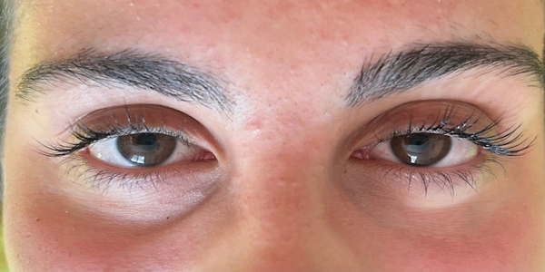 lifting de cils